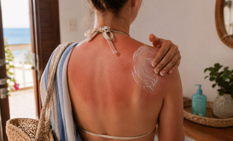 Mejores cremas para después del sol: cómo elegir el mejor aftersun
